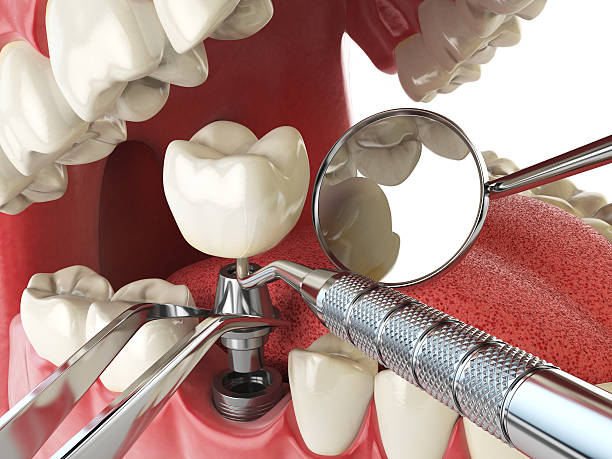 Best Weekend Emergency Dentist in Algoma, WI